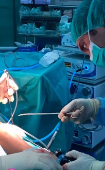 El Dr. Vicente López operando una fasciotomía de pierna en quirófano