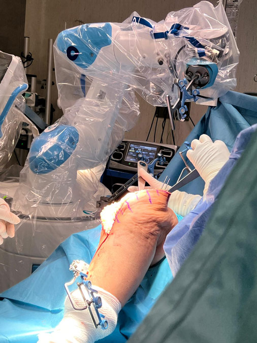 Robot rosa, cirugía prótesis de rodilla